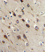 BDNF Antibody - Formalin-fixed and paraffin-embedded human brain reacted with BDNF Antibody , which was peroxidase-conjugated to the secondary antibody, followed by DAB staining. This data demonstrates the use of this antibody for immunohistochemistry; clinical relevance has not been evaluated.