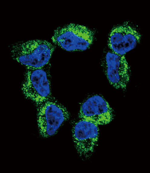 BDNF Antibody - Confocal immunofluorescence of BDNF Antibody with NCI-H460 cell followed by Alexa Fluor 488-conjugated goat anti-rabbit lgG (green). DAPI was used to stain the cell nuclear (blue).