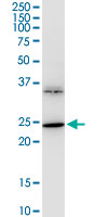 BDNF Antibody - BDNF monoclonal antibody (M02), clone 1B10. Western Blot analysis of BDNF expression in IMR-32.
