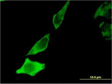 BDNF Antibody - Immunofluorescence of monoclonal antibody to BDNF on HeLa cell . [antibody concentration 10 ug/ml]