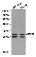 BDNF Antibody - Western blot of extracts of SH-SY5Y cell and PC-12 cell lines, using BDNF antibody.