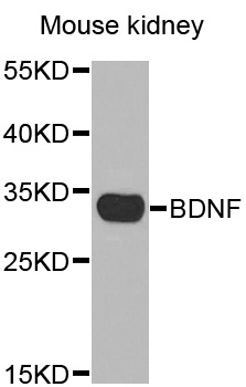 BDNF Antibody - Western blot analysis of extracts of Mouse kidney tissue, using BDNF antibody.