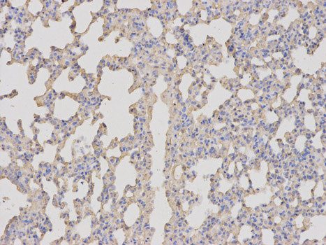 BDNF Antibody - Immunohistochemistry of paraffin-embedded rat lung using BDNF antibody at dilution of 1:100 (200x lens).
