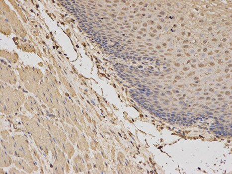 BDNF Antibody - Immunohistochemistry of paraffin-embedded human esophagus using BDNF antibody at dilution of 1:100 (200x lens).