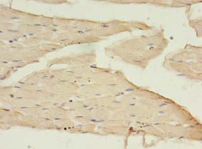 BDNF Antibody - Immunohistochemistry of paraffin-embedded human skeletal muscle tissue using antibody at 1:100 dilution.