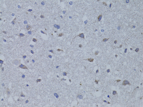 BDNF Antibody - Immunohistochemistry of paraffin-embedded rat brain using BDNF antibody at dilution of 1:100 (40x lens).
