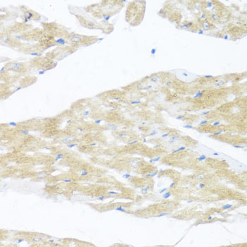 BDNF Antibody - Immunohistochemistry of paraffin-embedded mouse heart using BDNF antibody at dilution of 1:100 (40x lens).