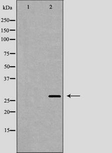 BDNF Antibody - Western blot analysis of extracts of SH-SY5Y using BDNF antibody. The lane on the left is treated with the antigen-specific peptide.