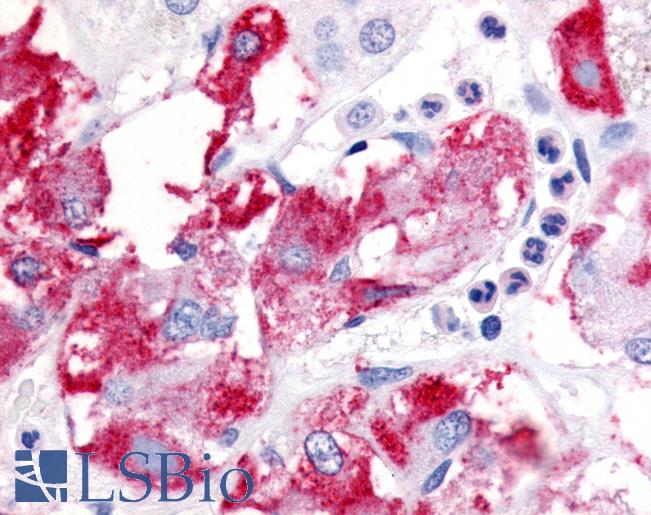 BECN1 / Beclin-1 Antibody - Anti-BECN1 / Beclin-1 antibody IHC of human adrenal medulla. Immunohistochemistry of formalin-fixed, paraffin-embedded tissue after heat-induced antigen retrieval. Antibody concentration 25 ug/ml.  This image was taken for the unconjugated form of this product. Other forms have not been tested.