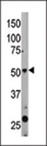 BECN1 / Beclin-1 Antibody - The anti-BECN1 antibody is used in Western blot to detect BECN1 in mouse liver tissue lysate. BECN1(arrow) was detected using the purified antibody.