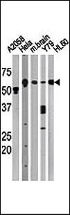 BECN1 / Beclin-1 Antibody - The anti-BECN1 antibody is used in Western blot to detect BECN1 in, from left to right, A2058, HeLa, mouse brain, Y79, and HL60 tissue lysates. BECN1(arrow) was detected using the purified antibody.