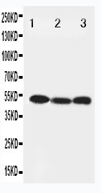 BECN1 / Beclin-1 Antibody - WB of BECN1 / Beclin-1 antibody. All lanes: Anti-BECN1 at 0.5ug/ml. Lane 1: HELA Whole Cell Lysate at 40ug. Lane 2: SW620 Whole Cell Lysate at 40ug. Lane 3: PANC Whole Cell Lysate at 40ug. Predicted bind size: 52KD. Observed bind size: 52KD.