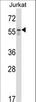 BECN1 / Beclin-1 Antibody - BECN1 Antibody (pT72) western blot of Jurkat cell line lysates (35 ug/lane). The BECN1 antibody detected the BECN1 protein (arrow).