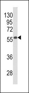 BECN1 / Beclin-1 Antibody - Western blot of Beclin1-BH3 Domain Antibody in mouse stomach tissue lysates (35 ug/lane). BECN1 (arrow) was detected using the purified antibody.