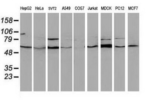 BECN1 / Beclin-1 Antibody - Western blot of extracts (35 ug) from 9 different cell lines by using anti-BECN1 monoclonal antibody.