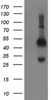 BECN1 / Beclin-1 Antibody - HEK293T cells were transfected with the pCMV6-ENTRY control (Left lane) or pCMV6-ENTRY BECN1 (Right lane) cDNA for 48 hrs and lysed. Equivalent amounts of cell lysates (5 ug per lane) were separated by SDS-PAGE and immunoblotted with anti-BECN1.