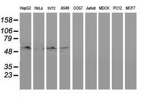 BECN1 / Beclin-1 Antibody - Western blot of extracts (35ug) from 9 different cell lines by using anti-BECN1 monoclonal antibody.
