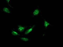 BECN1 / Beclin-1 Antibody - Immunofluorescent staining of HeLa cells using anti-BECN1 mouse monoclonal antibody.