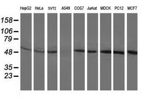 BECN1 / Beclin-1 Antibody - Western blot of extracts (35 ug) from 9 different cell lines by using anti-BECN1 monoclonal antibody.