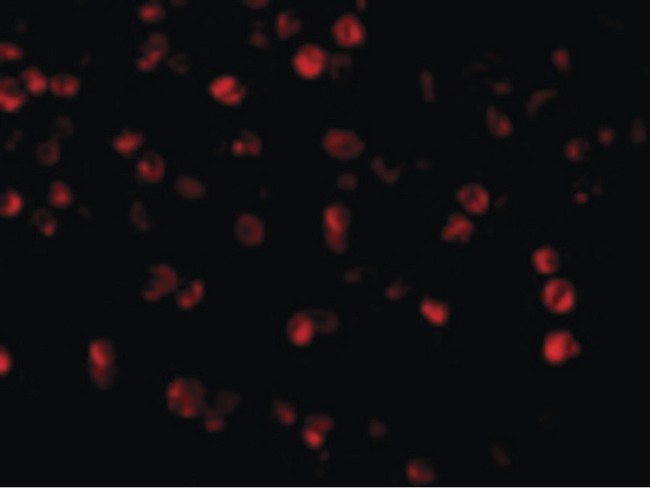 BECN1 / Beclin-1 Antibody - Immunofluorescence of Beclin-1 in A431 cells with Beclin-1 antibody at 2 ug/ml.
