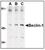 BECN1 / Beclin-1 Antibody - Western blot of Beclin-1 in A431 cell lysate with Beclin-1 antibody at (A) 0.5, (B) 1 and (C) 2 ug/ml.