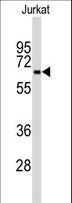 BECN1 / Beclin-1 Antibody - Western blot of anti-BECN1 Monoclonal Antibody in Jurkat cell line lysates (35 ug/lane). BECN1 (arrow) was detected using the antibody ascites (1:100 dilution).