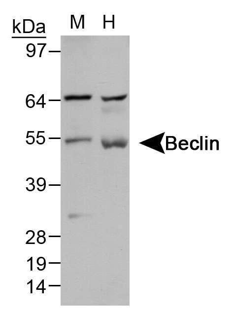 BECN1 / Beclin-1 Antibody - Detection of Beclin 1 in liver lysates. Lane 1: mouse liver Lane 2: human liver