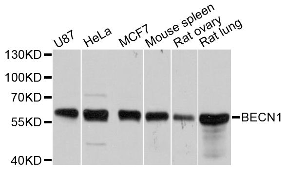 BECN1 / Beclin-1 Antibody - Western blot analysis of extracts of various cell lines, using BECN1 antibody at 1:1000 dilution. The secondary antibody used was an HRP Goat Anti-Rabbit IgG (H+L) at 1:10000 dilution. Lysates were loaded 25ug per lane and 3% nonfat dry milk in TBST was used for blocking. An ECL Kit was used for detection and the exposure time was 5s.
