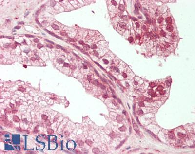 BECN1 / Beclin-1 Antibody - Human Prostate: Formalin-Fixed, Paraffin-Embedded (FFPE).  This image was taken for the unconjugated form of this product. Other forms have not been tested.