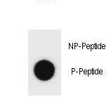 BECN1 / Beclin-1 Antibody - Dot blot of beclin 1 Antibody (Phospho S64) Phospho-specific antibody on nitrocellulose membrane. 50ng of Phospho-peptide or Non Phospho-peptide per dot were adsorbed. Antibody working concentrations are 0.6ug per ml.