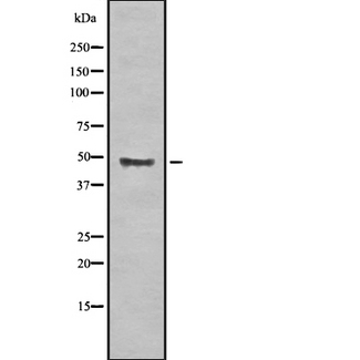 BECN2 Antibody - Western blot analysis of BECN1L1 expression in HEK293 cells. The lane on the left is treated with the antigen-specific peptide.