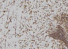 BECN2 Antibody - 1:100 staining human gastric tissue by IHC-P. The sample was formaldehyde fixed and a heat mediated antigen retrieval step in citrate buffer was performed. The sample was then blocked and incubated with the antibody for 1.5 hours at 22°C. An HRP conjugated goat anti-rabbit antibody was used as the secondary.