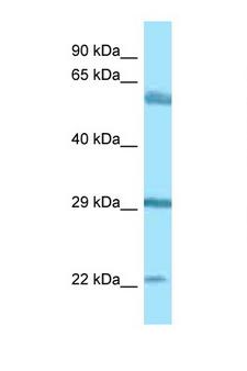 BEGAIN Antibody - BEGAIN antibody Western blot of 721_B Cell lysate. Antibody concentration 1 ug/ml.  This image was taken for the unconjugated form of this product. Other forms have not been tested.