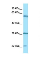BEGAIN Antibody - BEGAIN antibody Western blot of 721_B Cell lysate. Antibody concentration 1 ug/ml.  This image was taken for the unconjugated form of this product. Other forms have not been tested.