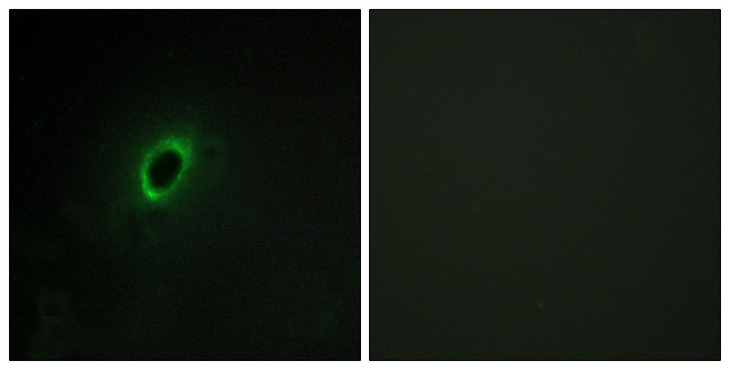 BEGAIN Antibody - Immunofluorescence analysis of HeLa cells, using BEGIN Antibody. The picture on the right is blocked with the synthesized peptide.