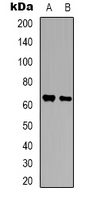 BEGAIN Antibody - Western blot analysis of BEGAIN expression in HeLa (A); SHSY5Y (B) whole cell lysates.