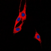 BEGAIN Antibody - Immunofluorescent analysis of BEGAIN staining in HeLa cells. Formalin-fixed cells were permeabilized with 0.1% Triton X-100 in TBS for 5-10 minutes and blocked with 3% BSA-PBS for 30 minutes at room temperature. Cells were probed with the primary antibody in 3% BSA-PBS and incubated overnight at 4 deg C in a humidified chamber. Cells were washed with PBST and incubated with a DyLight 594-conjugated secondary antibody (red) in PBS at room temperature in the dark. DAPI was used to stain the cell nuclei (blue).