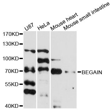 BEGAIN Antibody - Western blot analysis of extracts of various cell lines, using BEGAIN antibody at 1:3000 dilution. The secondary antibody used was an HRP Goat Anti-Rabbit IgG (H+L) at 1:10000 dilution. Lysates were loaded 25ug per lane and 3% nonfat dry milk in TBST was used for blocking. An ECL Kit was used for detection and the exposure time was 90s.