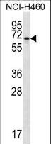 BEND4 Antibody - BEND4 Antibody western blot of NCI-H460 cell line lysates (35 ug/lane). The BEND4 antibody detected the BEND4 protein (arrow).