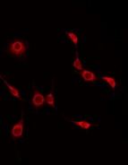 BEND4 Antibody - Staining HuvEc cells by IF/ICC. The samples were fixed with PFA and permeabilized in 0.1% Triton X-100, then blocked in 10% serum for 45 min at 25°C. The primary antibody was diluted at 1:200 and incubated with the sample for 1 hour at 37°C. An Alexa Fluor 594 conjugated goat anti-rabbit IgG (H+L) Ab, diluted at 1/600, was used as the secondary antibody.