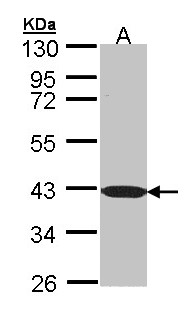 BEND5 Antibody - Sample (30 ug of whole cell lysate). A: Molt-4 . 10 % SDS PAGE. BEND5 antibody diluted at 1:1000
