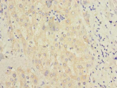 BEND7 Antibody - Immunohistochemistry of paraffin-embedded human liver tissue using antibody at dilution of 1:100.