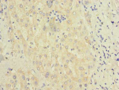 BEND7 Antibody - Immunohistochemistry of paraffin-embedded human liver tissue using BEND7 Antibody at dilution of 1:100