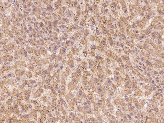 BEND7 Antibody - Immunochemical staining of human BEND7 in human liver with rabbit polyclonal antibody at 1:100 dilution, formalin-fixed paraffin embedded sections.