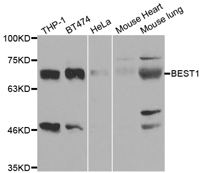 BEST1 / BEST / Bestrophin Antibody - Western blot analysis of extracts of various cell lines.