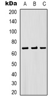 BEST1 / BEST / Bestrophin Antibody - Western blot analysis of Bestrophin-1 expression in PC3 (A); mouse brain (B); rat brain (C) whole cell lysates.