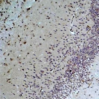 BEST1 / BEST / Bestrophin Antibody - Immunohistochemical analysis of Bestrophin-1 staining in rat brain formalin fixed paraffin embedded tissue section. The section was pre-treated using heat mediated antigen retrieval with sodium citrate buffer (pH 6.0). The section was then incubated with the antibody at room temperature and detected using an HRP conjugated compact polymer system. DAB was used as the chromogen. The section was then counterstained with hematoxylin and mounted with DPX.