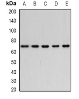 BEST1 / BEST / Bestrophin Antibody - Western blot analysis of Bestrophin expression in THP1 (A); BT474 (B); HeLa (C); mouse heart (D); mouse lung (E) whole cell lysates.