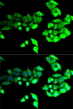 BEST1 / BEST / Bestrophin Antibody - Immunofluorescence analysis of U2OS cells using BEST1 antibody. Blue: DAPI for nuclear staining.