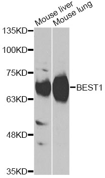 BEST1 / BEST / Bestrophin Antibody - Western blot analysis of extracts of various cell lines, using BEST1 antibody at 1:1000 dilution. The secondary antibody used was an HRP Goat Anti-Rabbit IgG (H+L) at 1:10000 dilution. Lysates were loaded 25ug per lane and 3% nonfat dry milk in TBST was used for blocking.